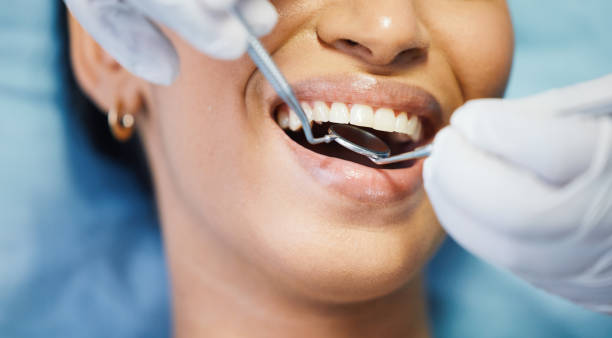Best Broken or Cracked Tooth Emergency Dentist in Ramapo College Of New Jersey, NJ